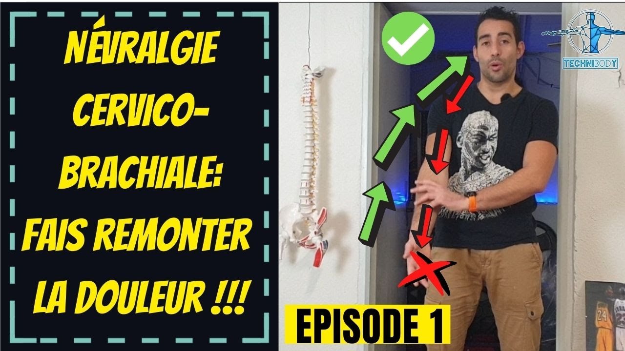 Névralgie cervico-brachiale ( NCB) - traitement et exercice kiné ( fais remonter la douleur )