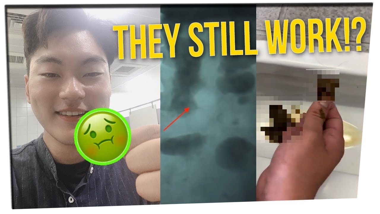 Man Accidentally Swallows & Retrieves Airpod