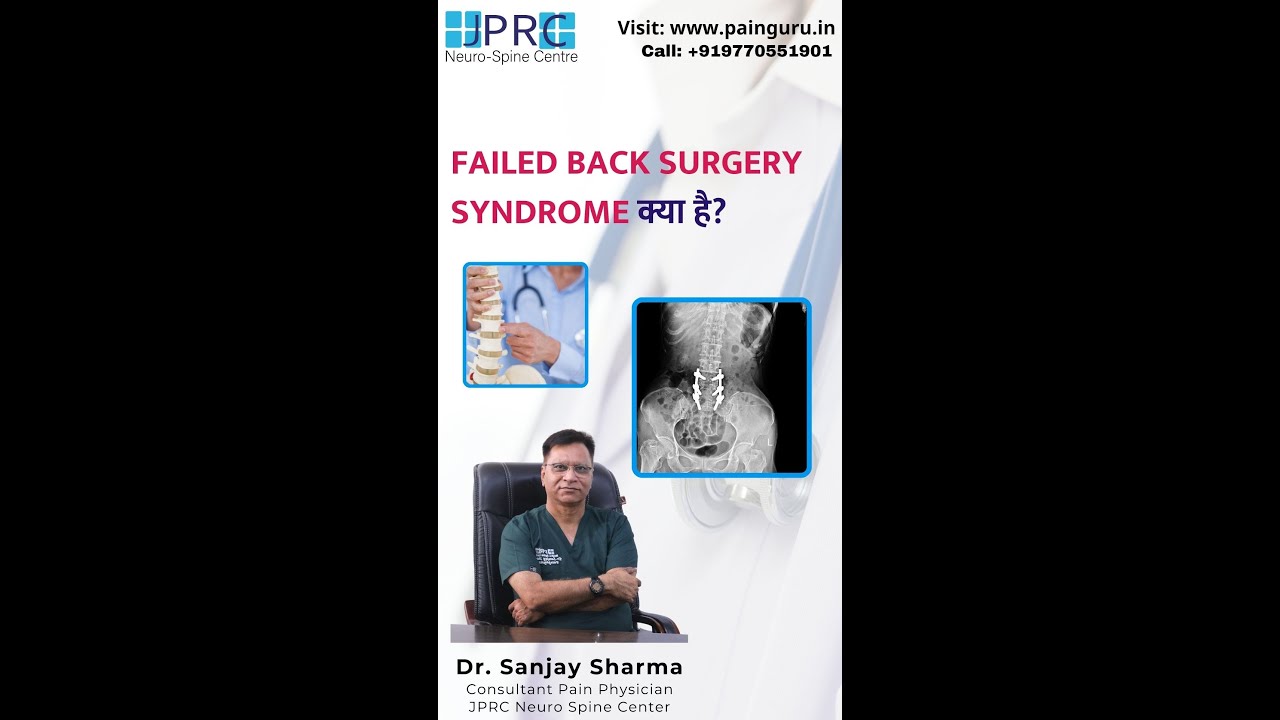 Failed back Surgery treatment without operation at JPRC Jaipur
