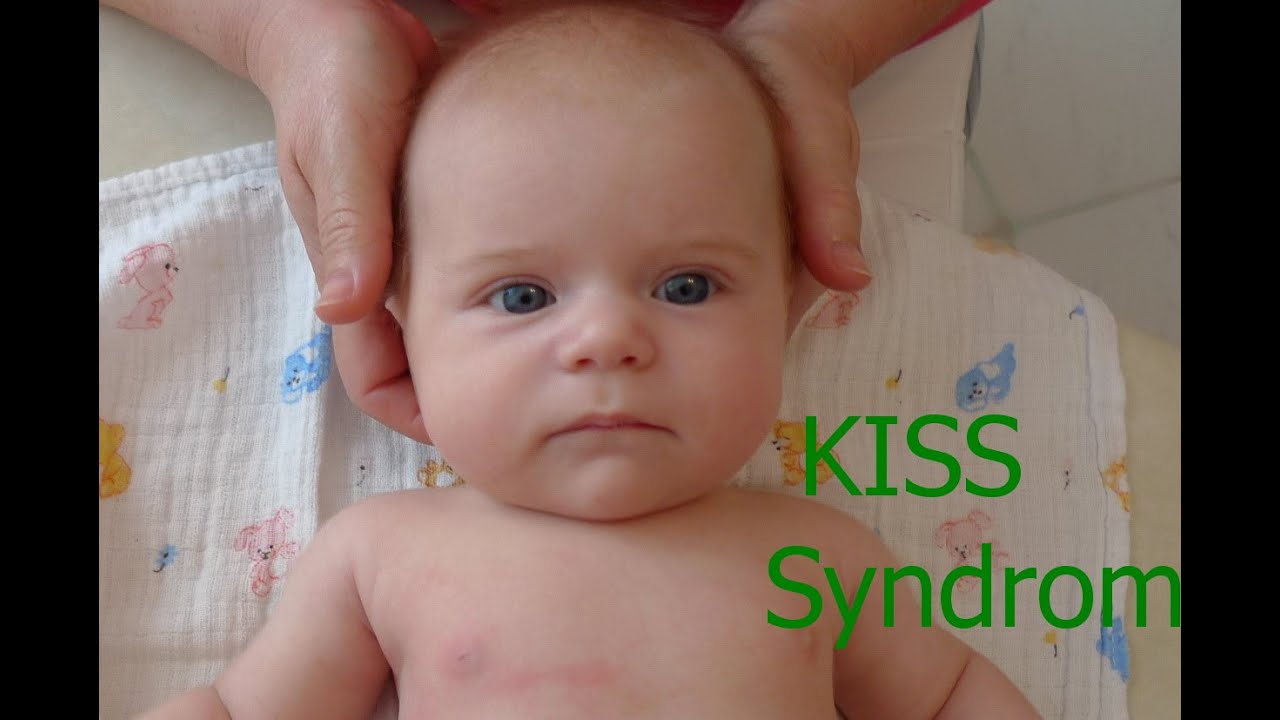 KISS Syndrom bei Babys. Kommt  das oft vor und wie kann man es erkennen?