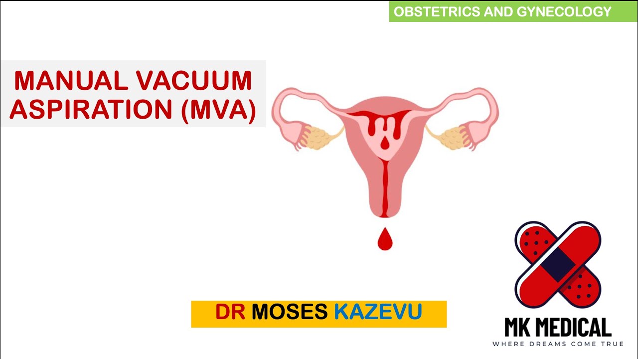 Manual Vacuum Aspiration (MVA)