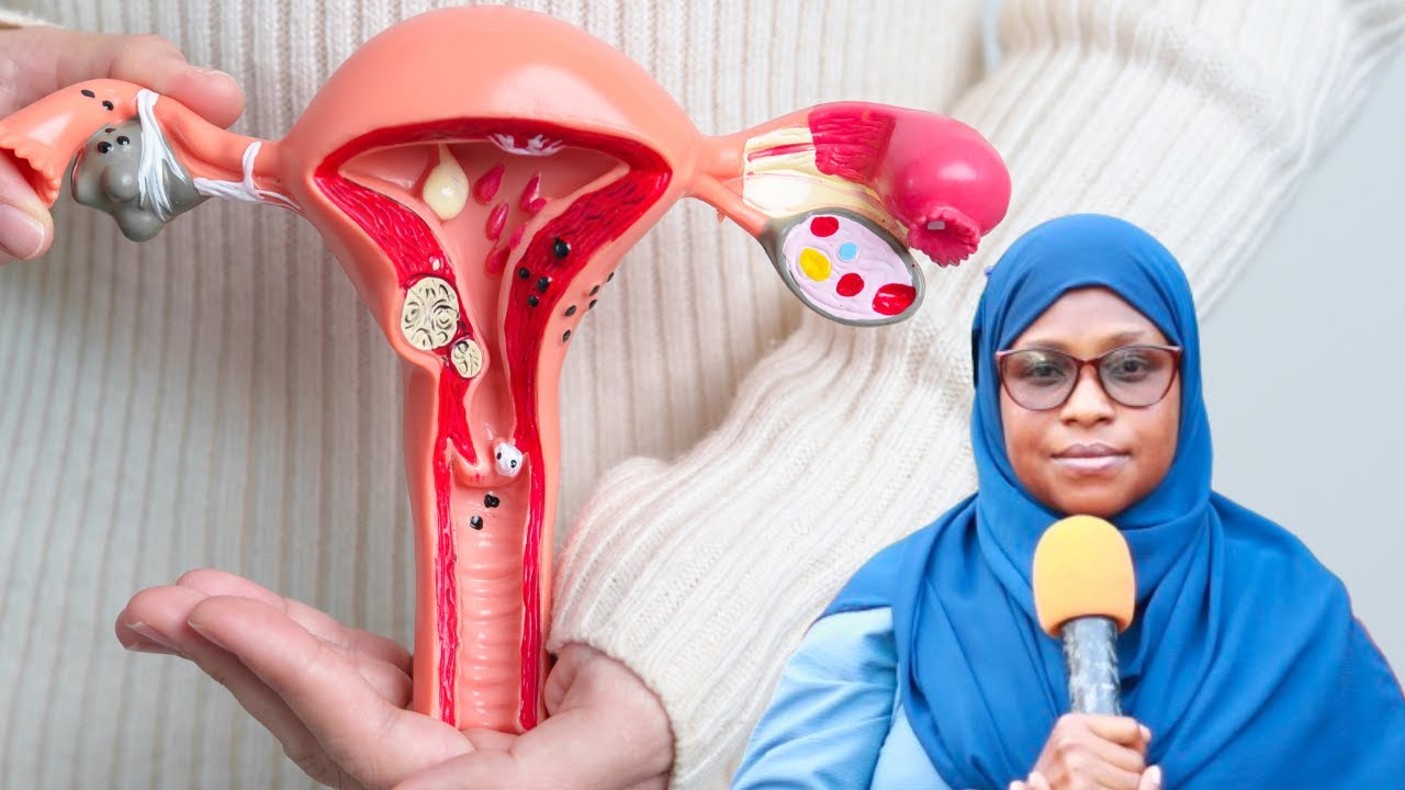 Uvimbe Hatari unaowapata wanawake wengi Tumboni na namna ya kuutibu - Dr Baiya Kissiwa