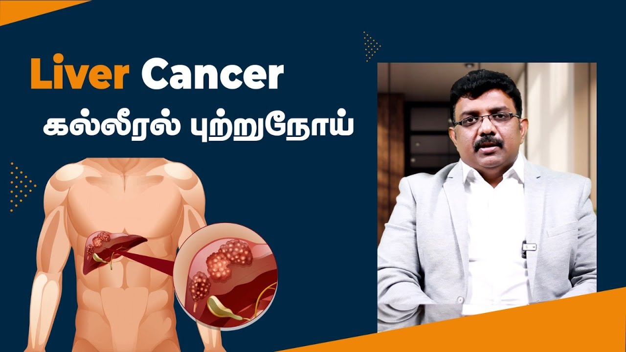 கல்லீரல் புற்றுநோய்க்கான அறிகுறிகள் & சிகிச்சைகள் மற்றும் வராமல் எவ்வாறு தடுப்பது? | Dr John Grifson
