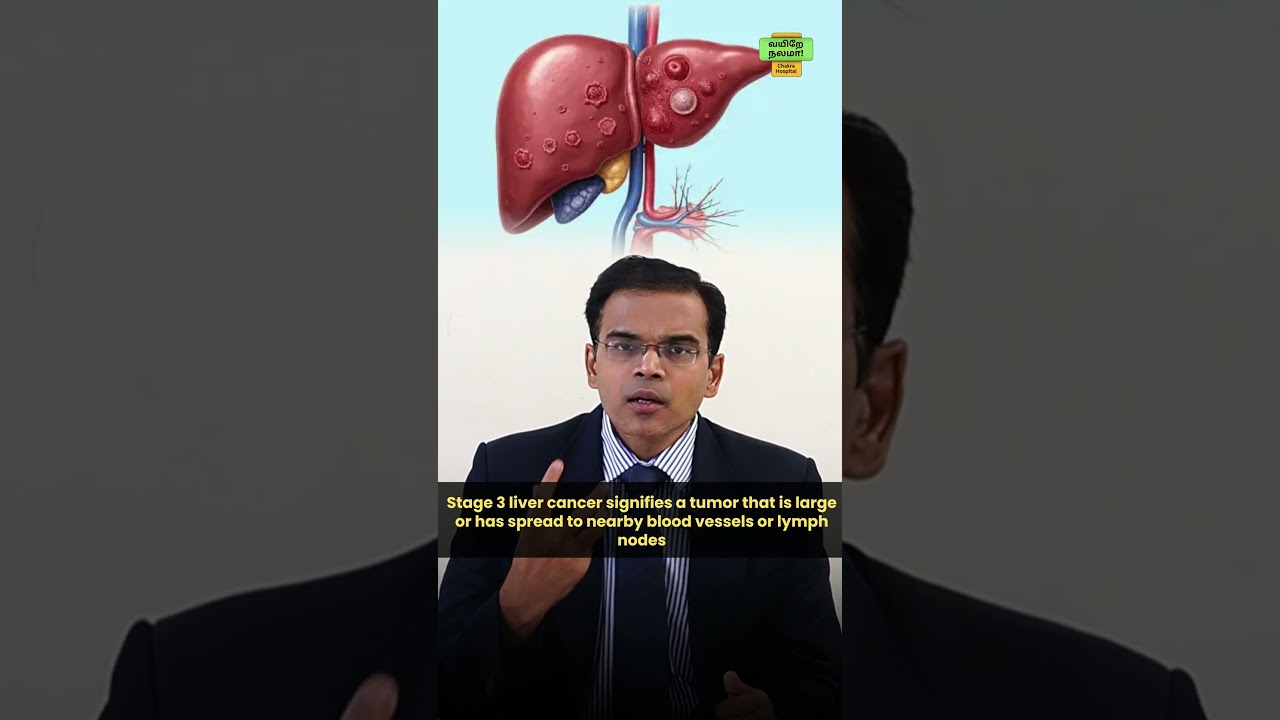 💙🔍 From stage 1 to stage 4 &ndash; know the journey of liver cancer 📊  #LiverCancer #trending