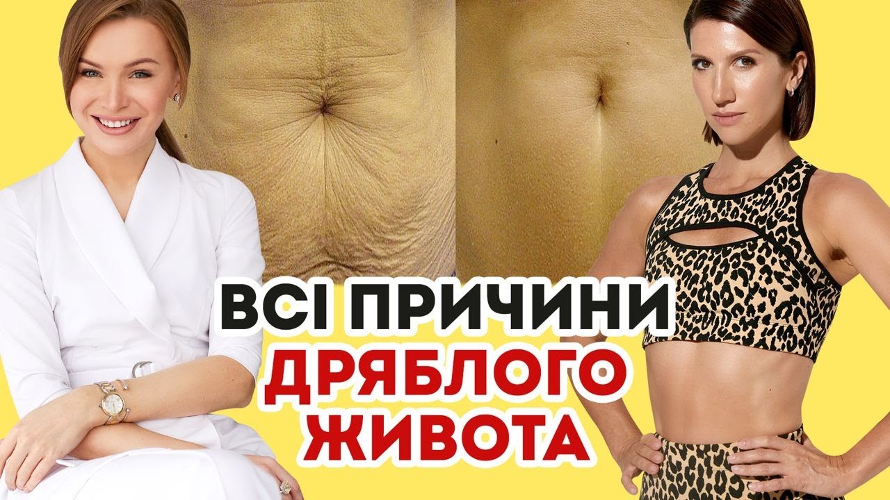 Прибрати живіт і знайти ПРЕС: відверто про ВСІ ПРИЧИНИ дряблої шкіри // ЇЖА, СПОРТ, ГОРМОНИ