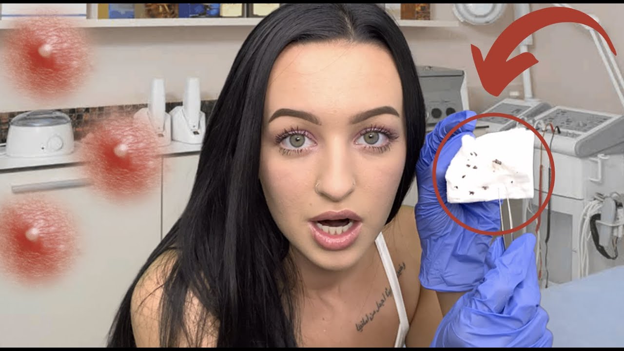 [ASMR] Удаление черных точек и маска для носа RP