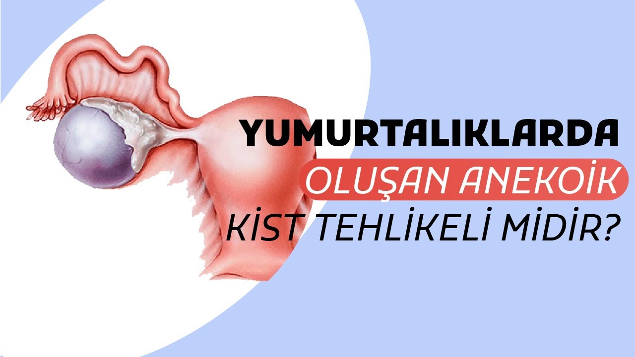 Anekoik Kist Nedir? Yumurtalıklarda Oluşan Anekoik Kistler Tehlikeli Midir? - Prof. Dr. Gamze Sinem