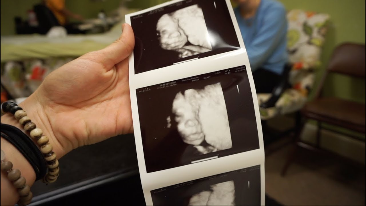 VLOG 97:  Loryn's Ultrasound and I Secretley videotaped Clayton