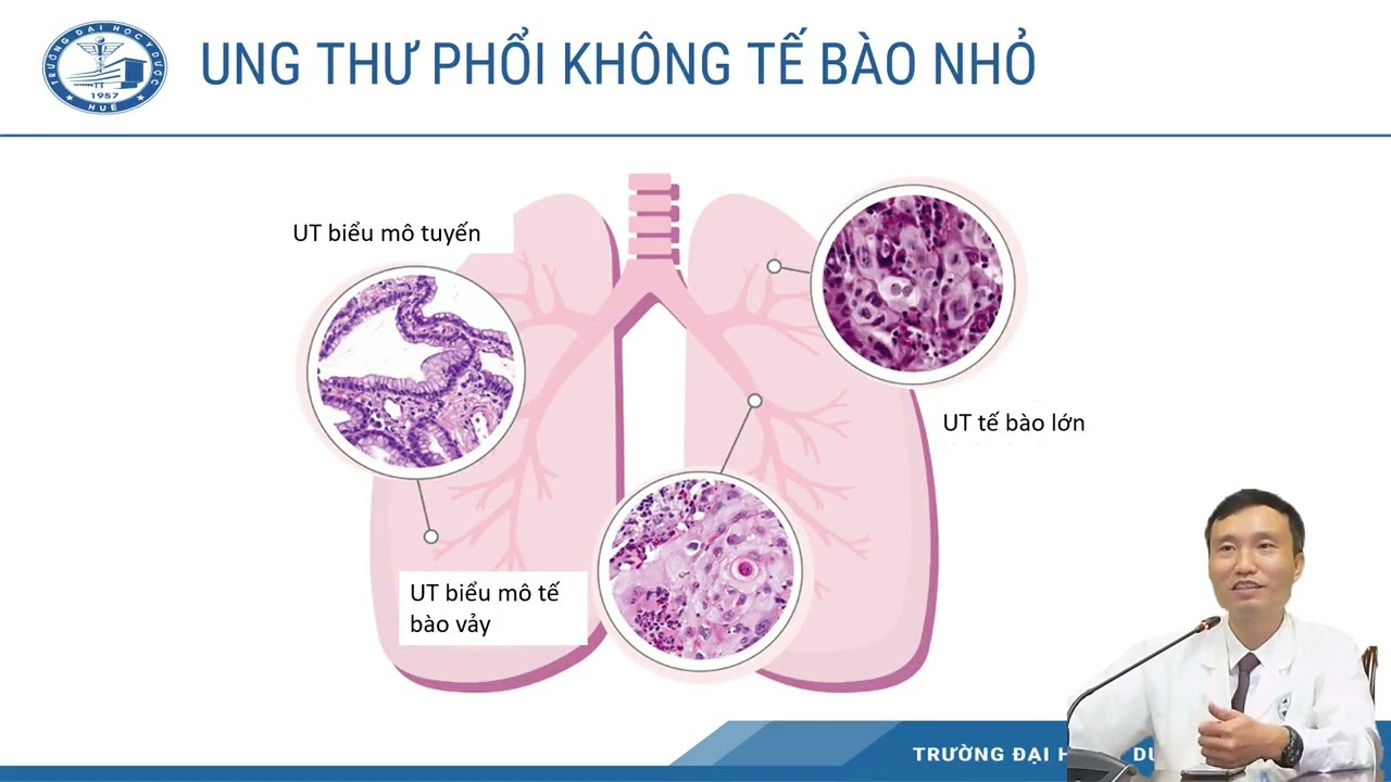 NHỮNG CƠ HỘI MỚI TRONG ĐIỀU TRỊ UNG THƯ PHỔI | TS.BS. Hồ Xuân Dũng