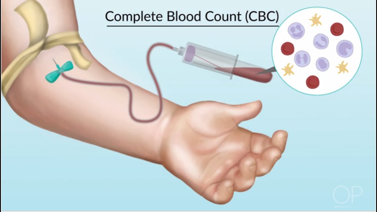 Understanding Complete Blood Counts by S. Rosen, L. Corr, L. DelSignore | OPENPediatrics