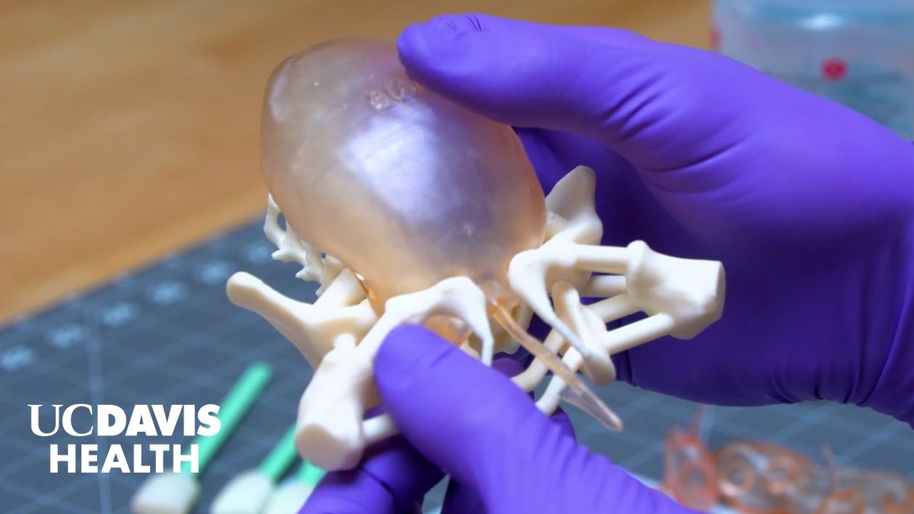 3D Printed Models Provide Road Map to Rare Cloacal Repair Surgeries