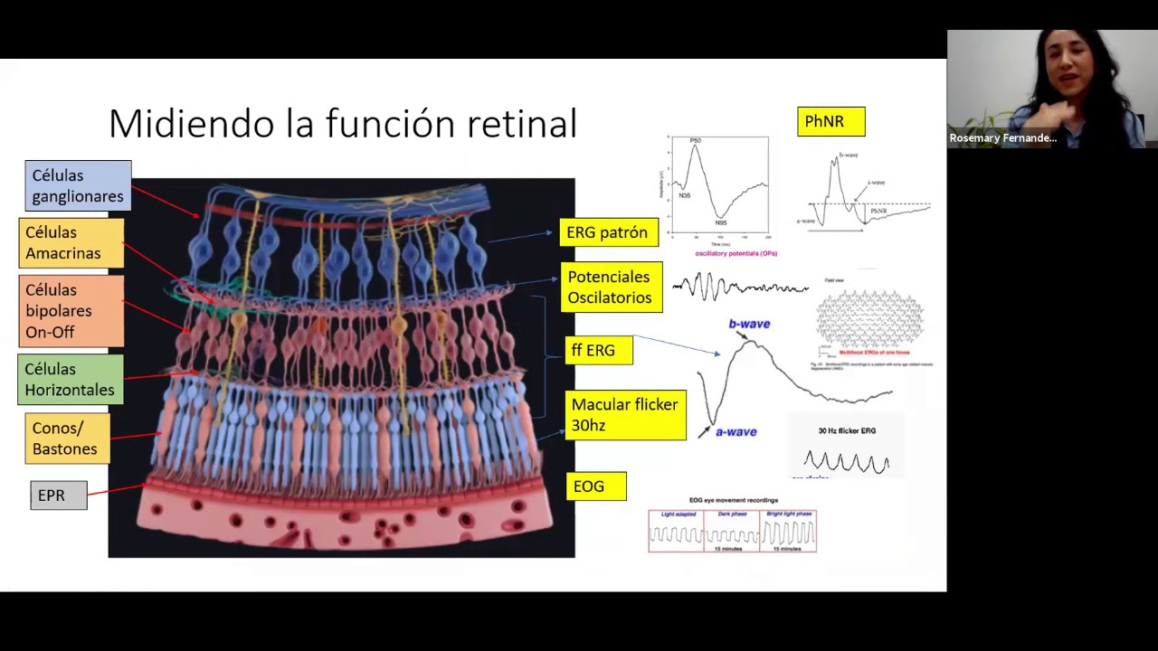 GRAND ROUNDS - EL ABC DE LA ELECTROFISIOLOGÍA