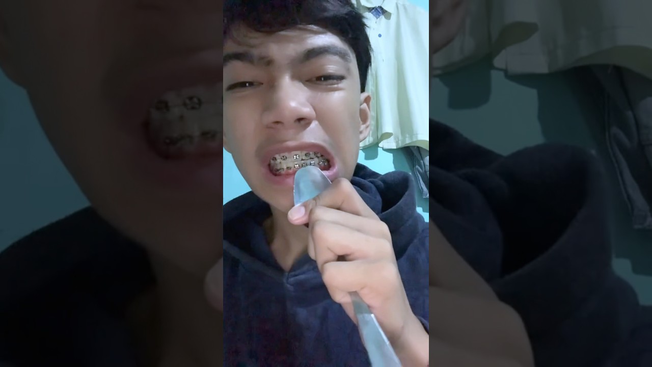 No te quites los brackets en casa🚨 #bracket #ortodoncia #dentista #dental #odontologia #fyp