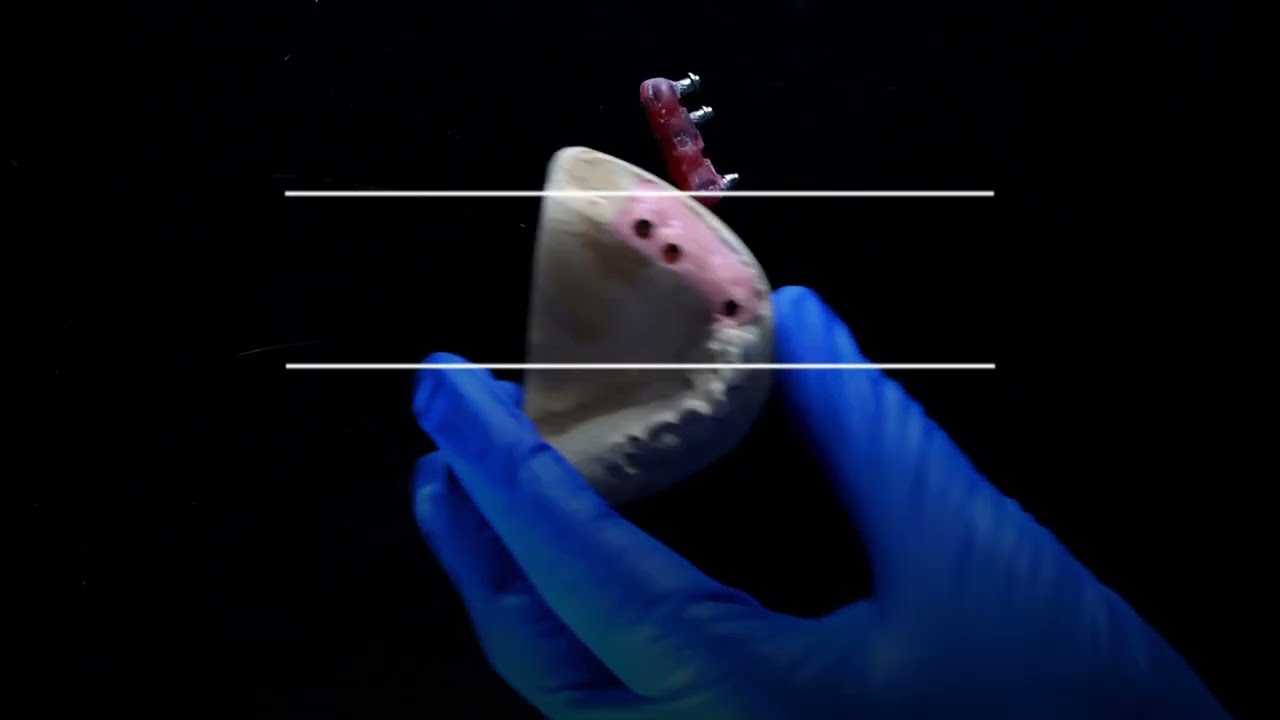 VERIFICATION JIG | CAD CAM Dental Lab.