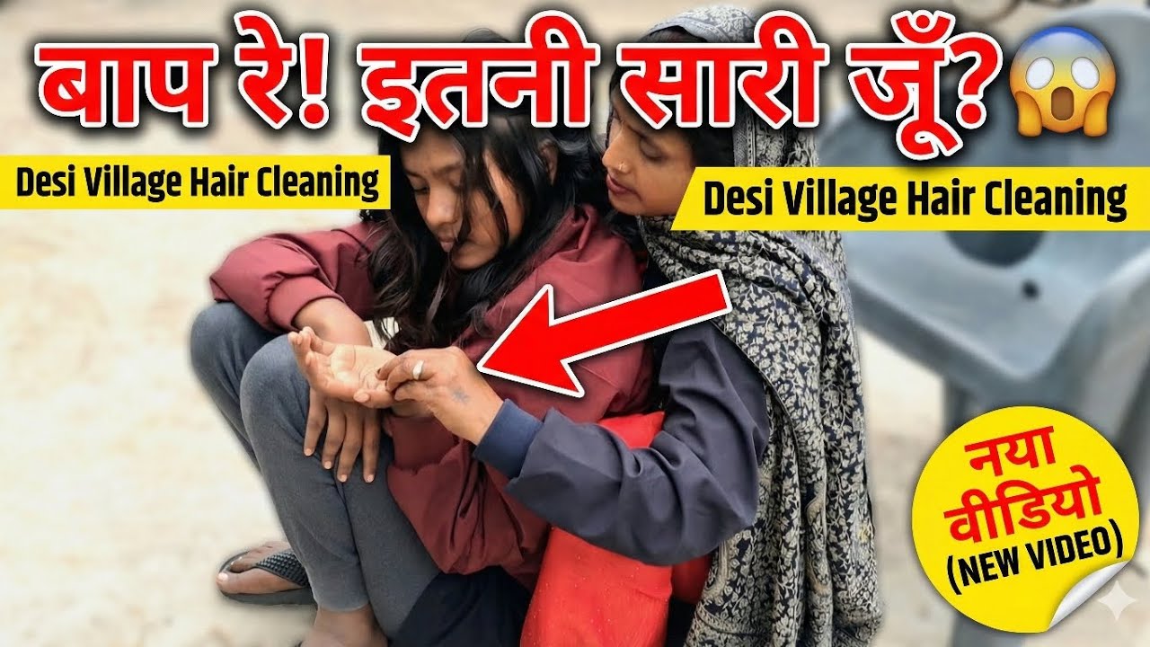 Balon Me Itna Sara Juu 😱 Bap Re! | Real Nitpicking Hair Cleaning