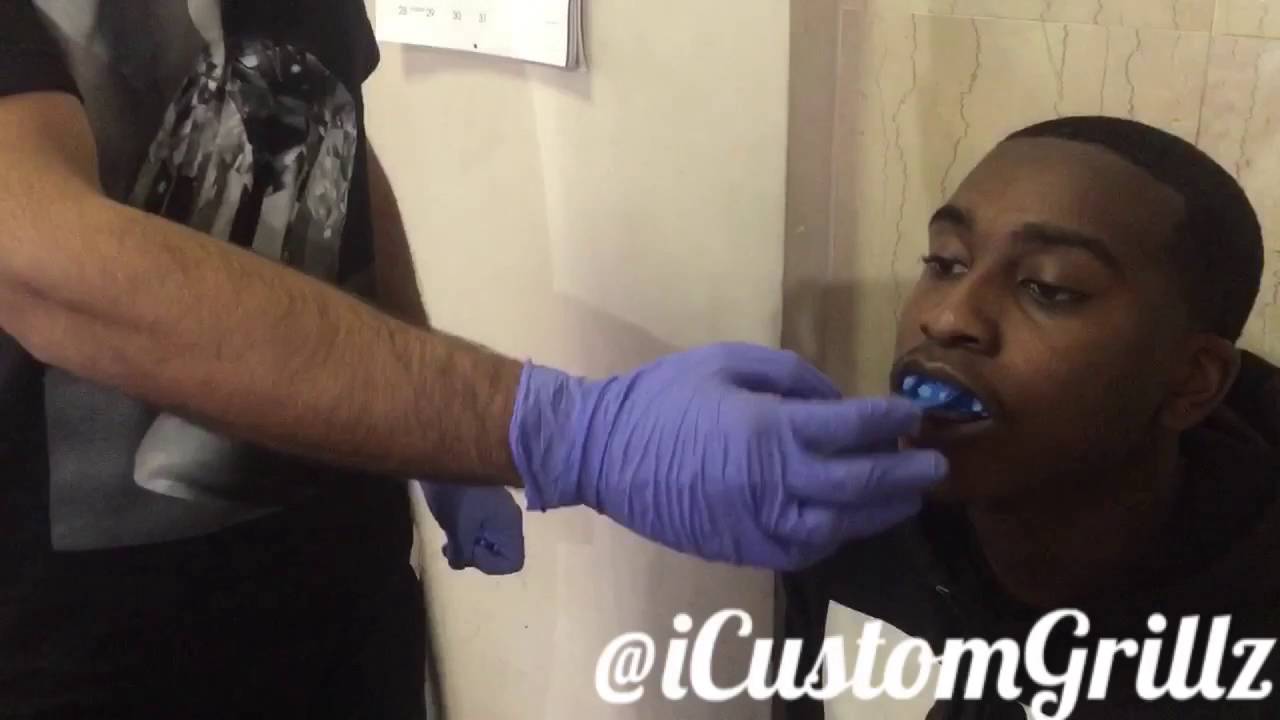 HOW TO TAKE A MOLD FOR YOUR CUSTOM GRILLZ