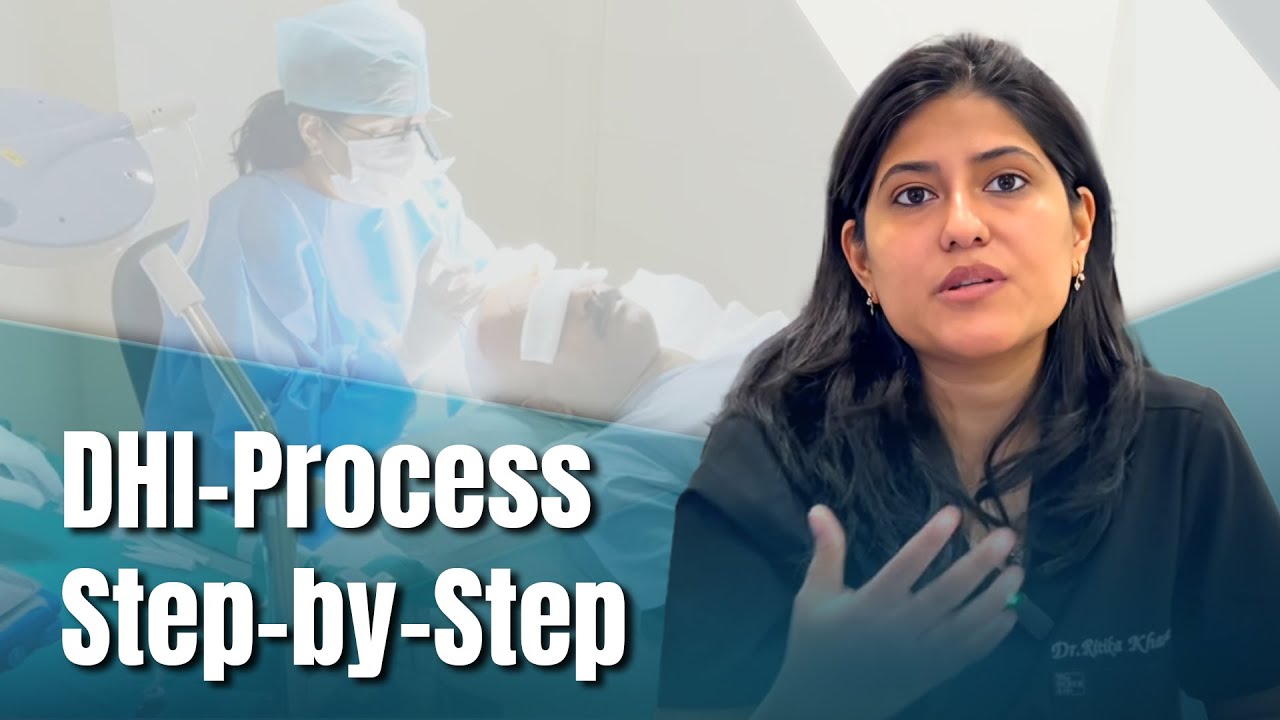 Dive into the Step-by-Step Process of DHI Hair Transplantation!