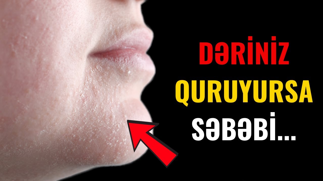 Dəri quruluğunun yaranmasının səbəbi nədir?