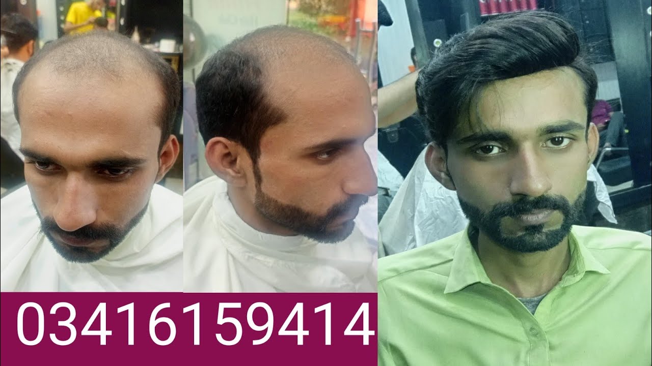 USA Base Hair Wig | USA  Hair Patch | by Sufyan Rehmani Rawalpindi | pakistan