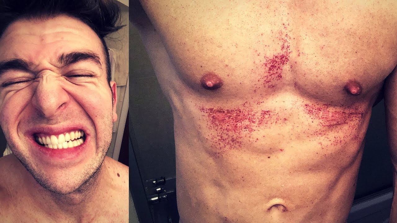 CHEMICAL BURNED WITH NAIR | Watch This Before Using Nair For Hair Removal