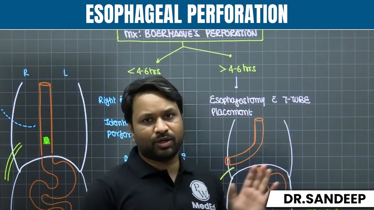 Esophageal Perforation | Surgery | Bailey learned with Dr. Sandeep | PW MedEd
