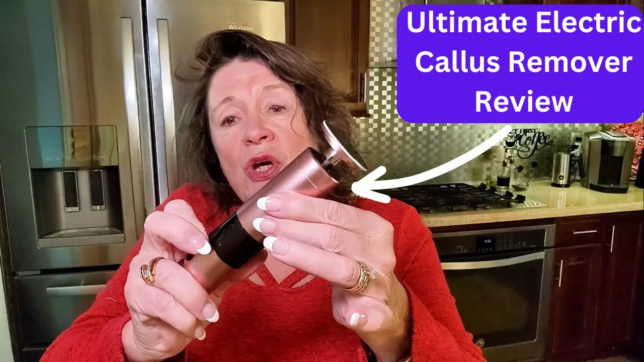 Ultimate Electric Callus Remover Review! 👣✨ Say Goodbye to Dry, Dead Skin!