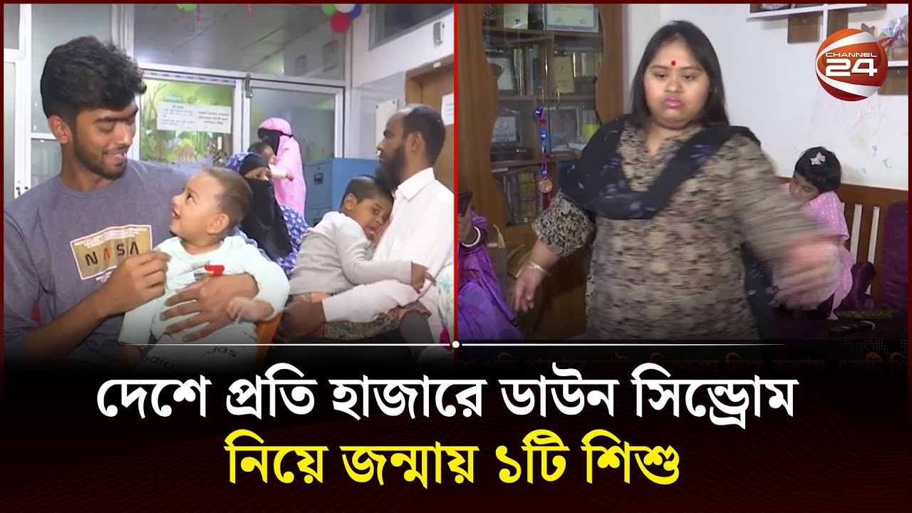 দেশে প্রতি হাজারে ডাউন সিন্ড্রোম নিয়ে জন্মায় ১টি শিশু | Down Syndrome | Channel 24