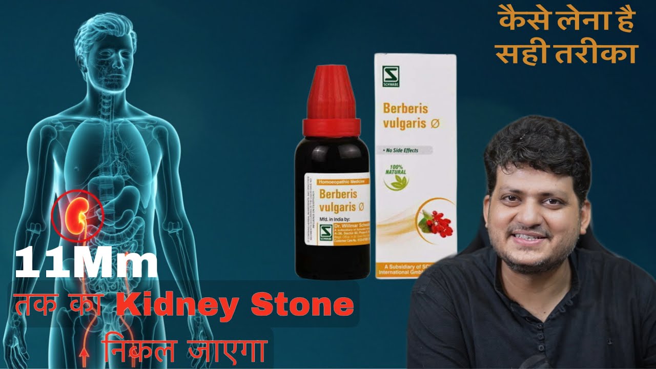 कैसे Use करे Homeopathic Medicine Berberis Vulgaris  How  To Use 