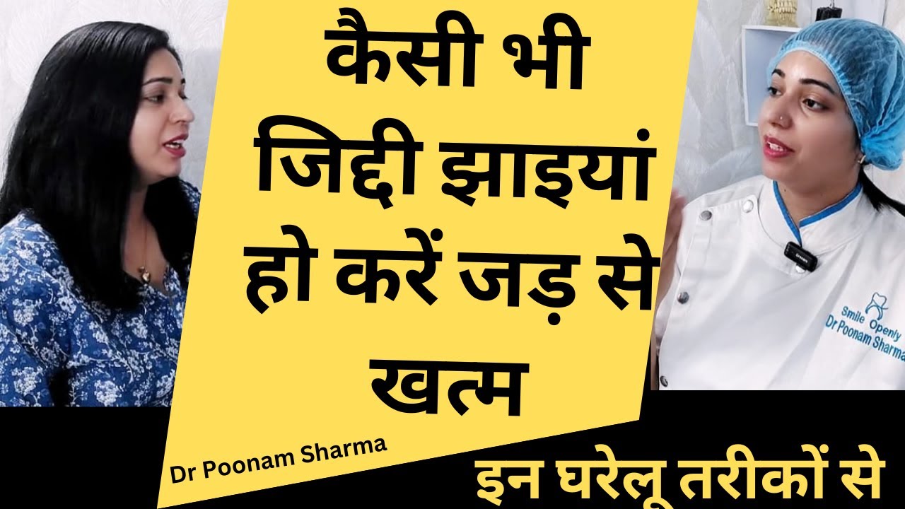 चेहरे की जिद्दी झाइयों को जड़ से ख़त्म करने के घरेलू नुस्खे | Pigmentation Treatment |