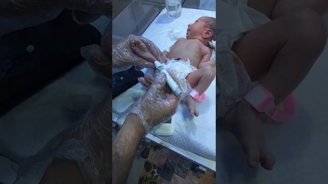 Newborn Baby Checking RBS | Blood Sugar Test in NICU 👶🩸 #NewbornBaby #BloodSugarTest#cute#Neonatal