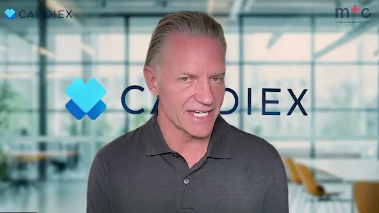 CardieX's CONNEQT Pulse is set to launch, tracking heart health from your own home