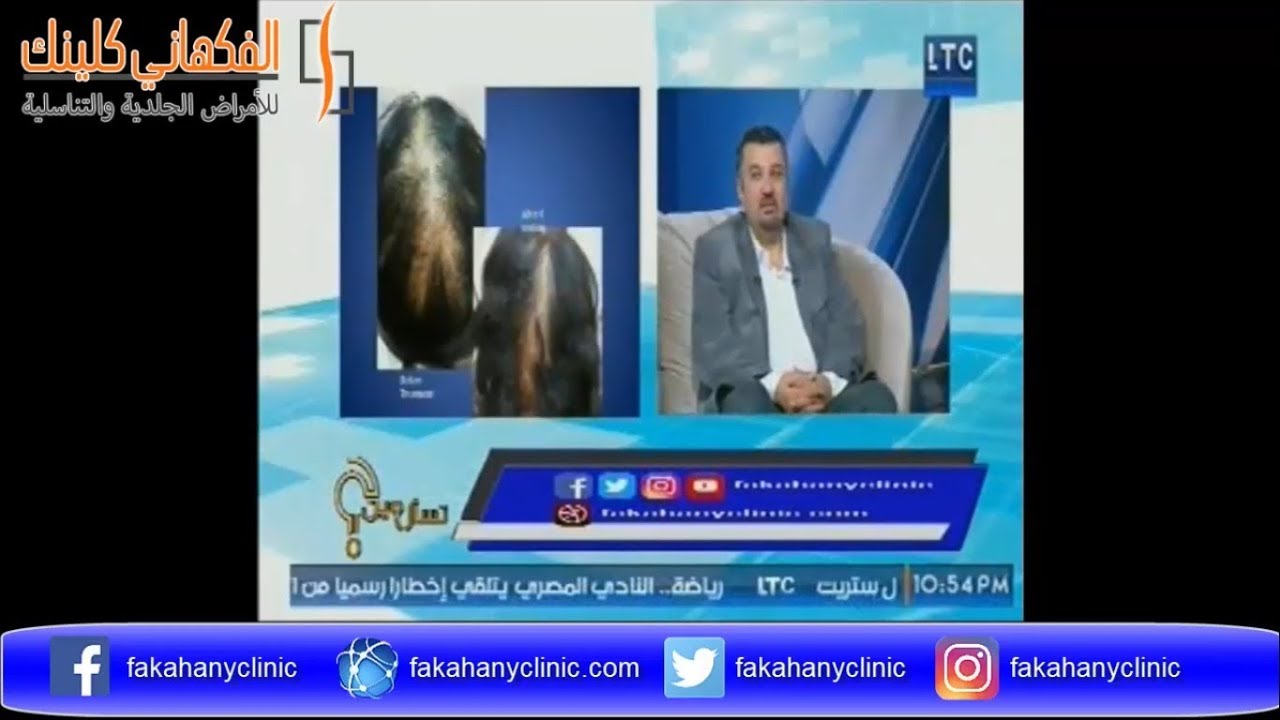 علاج الثعلبة وتساقط الشعر مع د حسن الفكهاني في برنامج تسأل مين - الحلقة السابعة