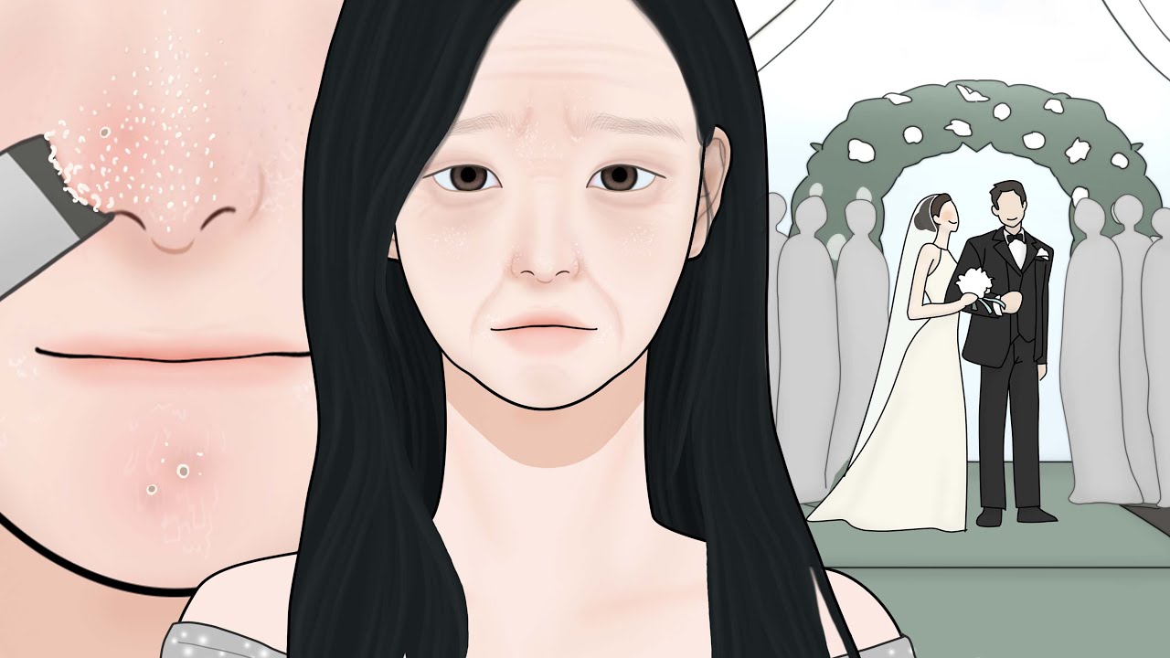 친구의 결혼식에 이 상태로 갈 수 있을까? / 여드름 압출, 안티에이징 스킨케어 피부관리 ASMR 루루팡