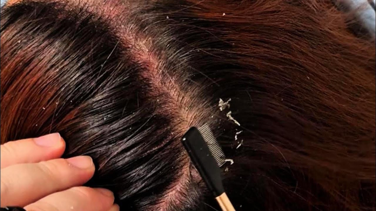 JOJO’s ASMR Scalp Care — Precise Tweezer Touches & Ordered Comb Flow | No Talking