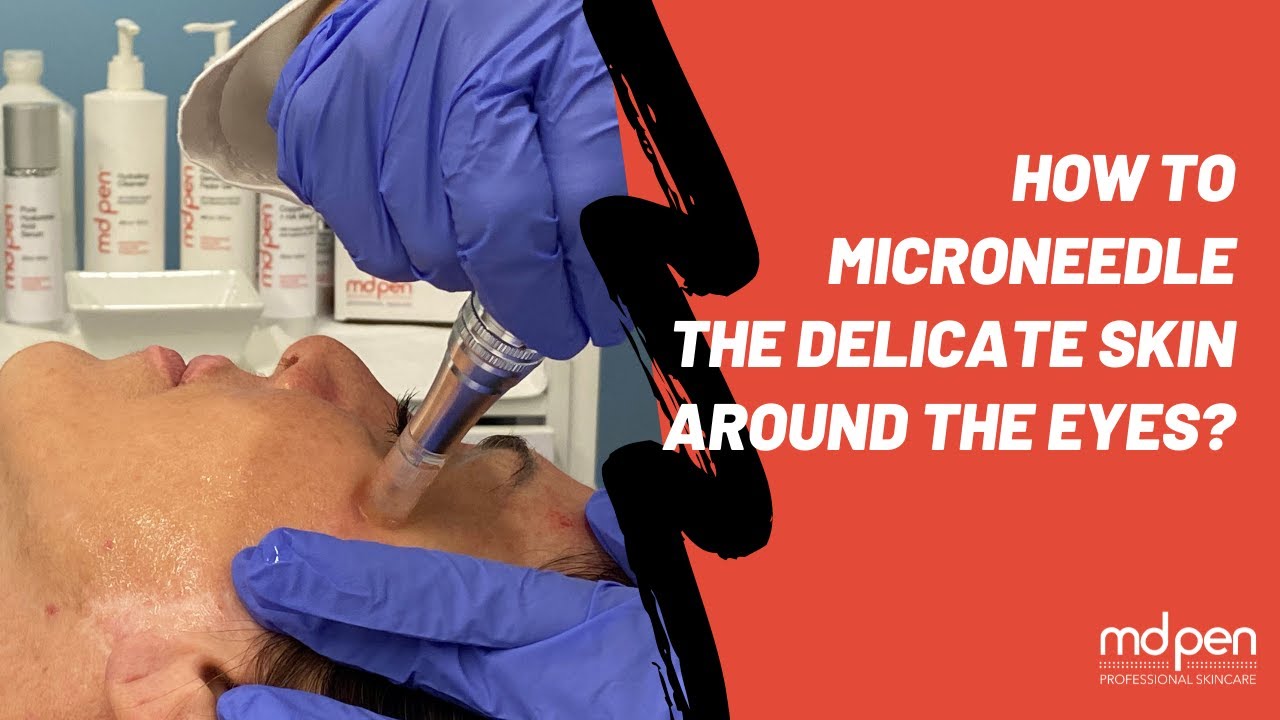 How to Microneedle the delicate skin around the eyes?