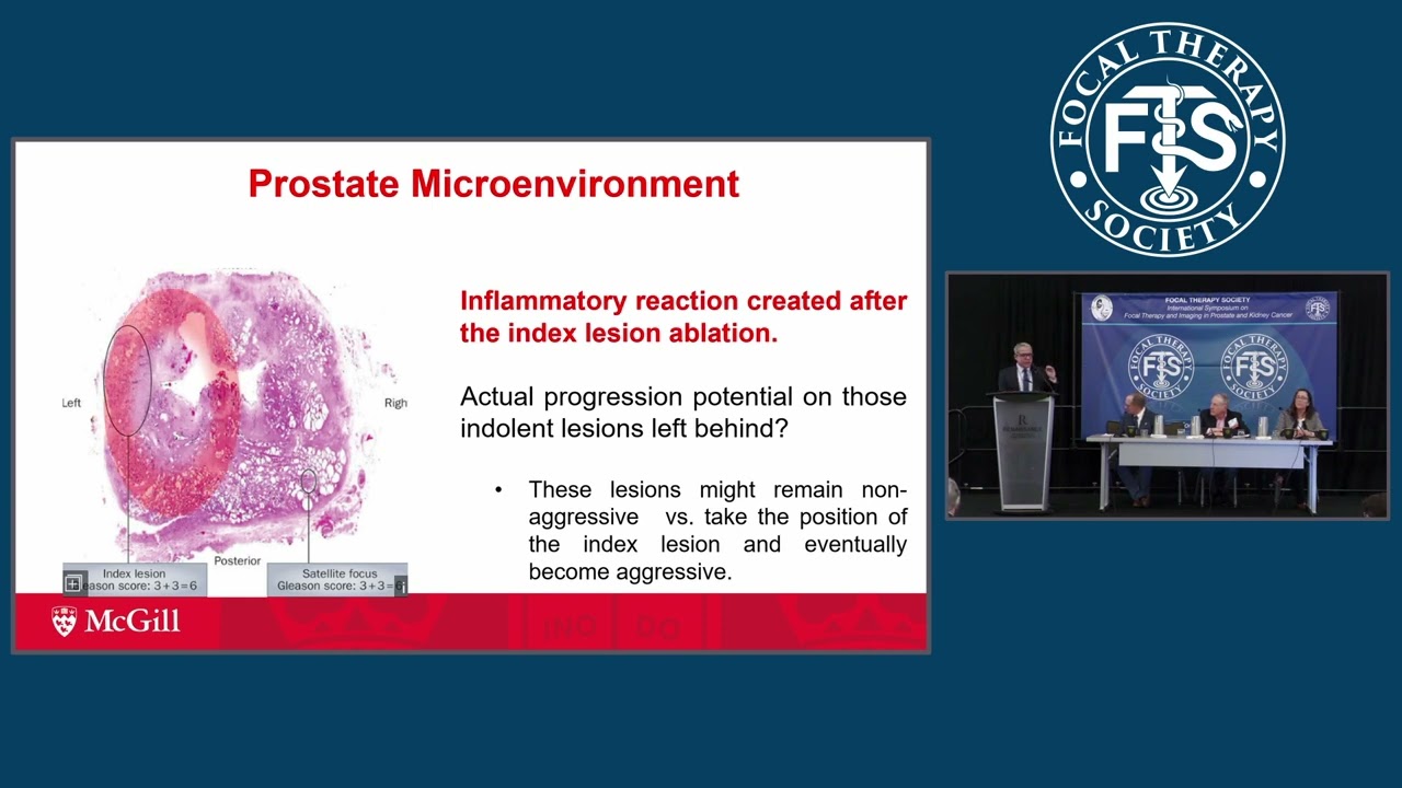 Critical Debate: Focal Therapy vs. Whole Gland Treatment for Prostate Cancer PGG 2/3