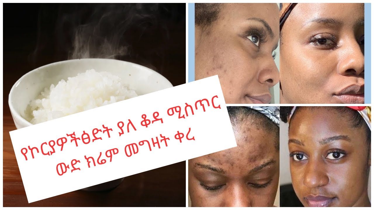 Rice Flour, Honey & Yogurt Face Mask for CLEAR, GLOWING, SPOTLESS Skin! | ለሚያበራ ቆዳ