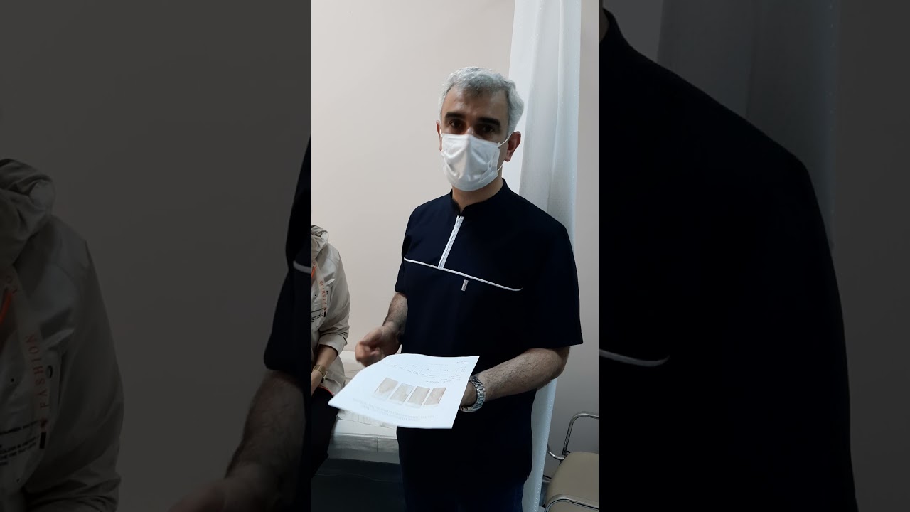 💠Biopsiyadan qorxma📌
Düyünlü zobu olan pasiyentimizi biopsiya etdik. Biopsiya haqqında təəsüratları👌