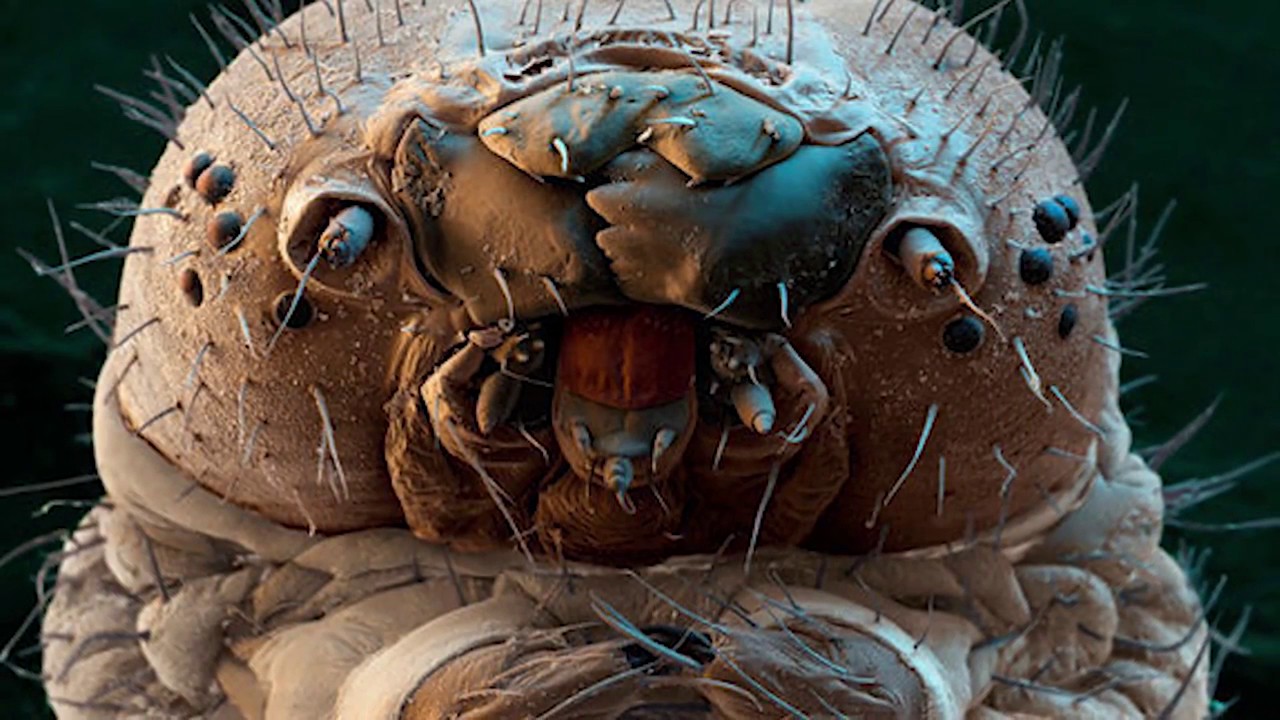 Dr. Scot Morris Discusses Demodex Mite and Acne