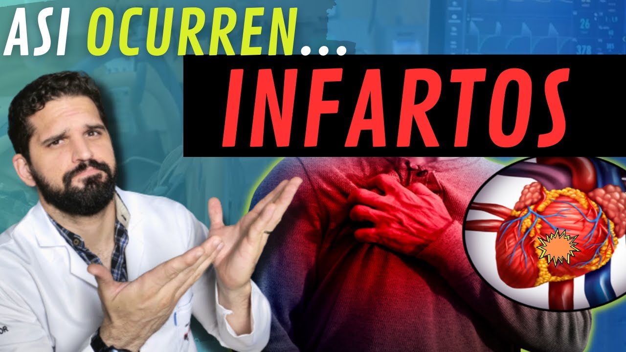 ¡SORPRENDENTE¡ Asi es como OCURREN los INFARTOS AL CORAZÓN 😳🩺