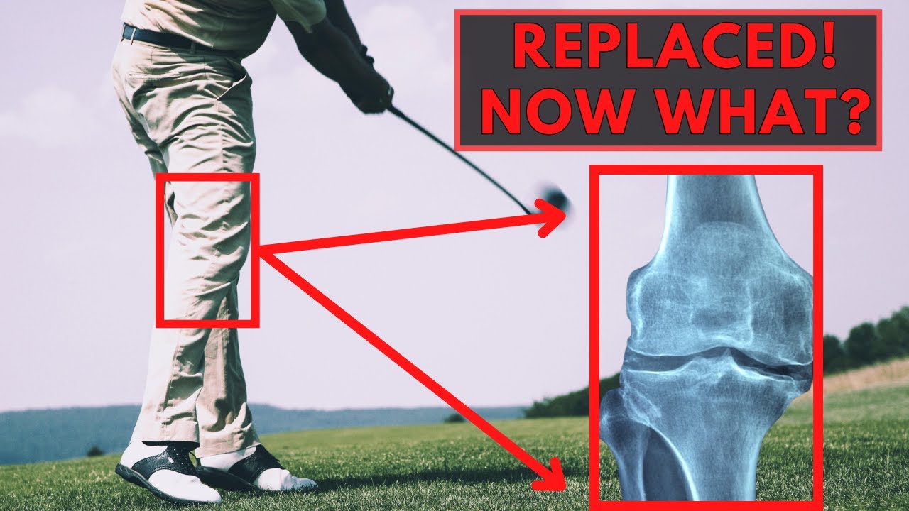 Swing Again: 3 Keys to Master Golf after Total Knee Replacement
