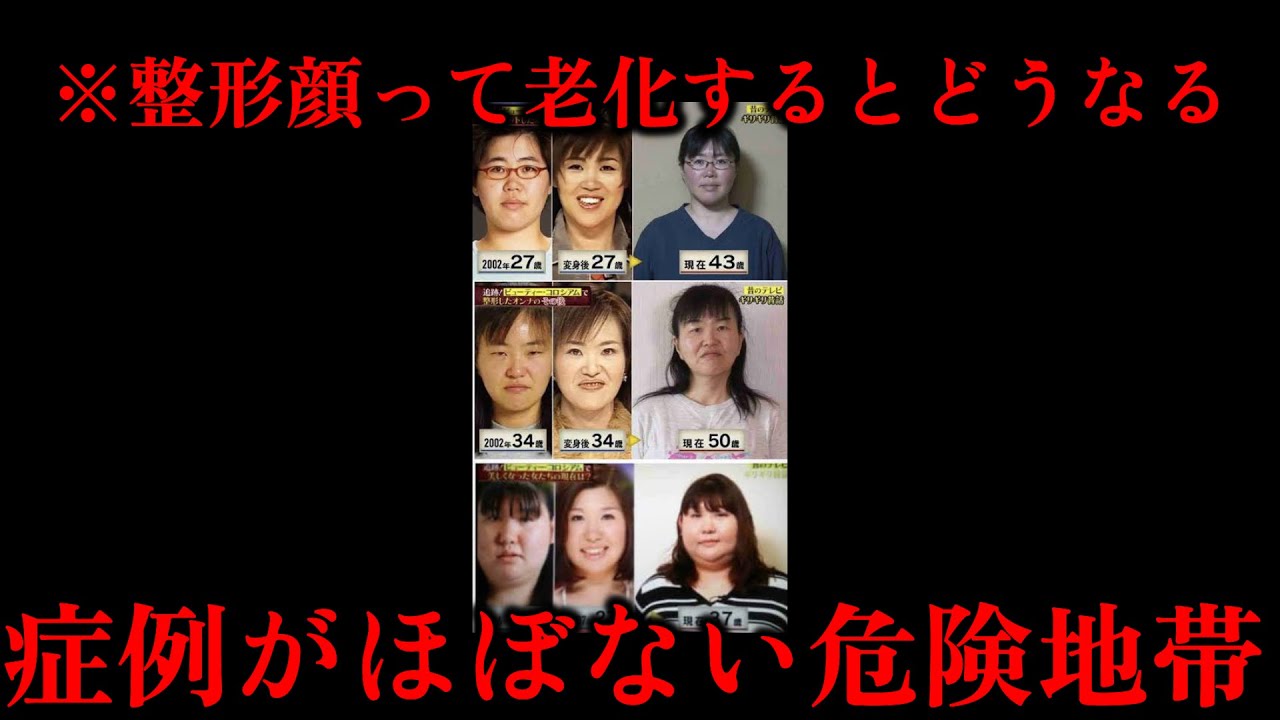 【整形と老化】美容整形外科医が皆わかってて言わないことを話します