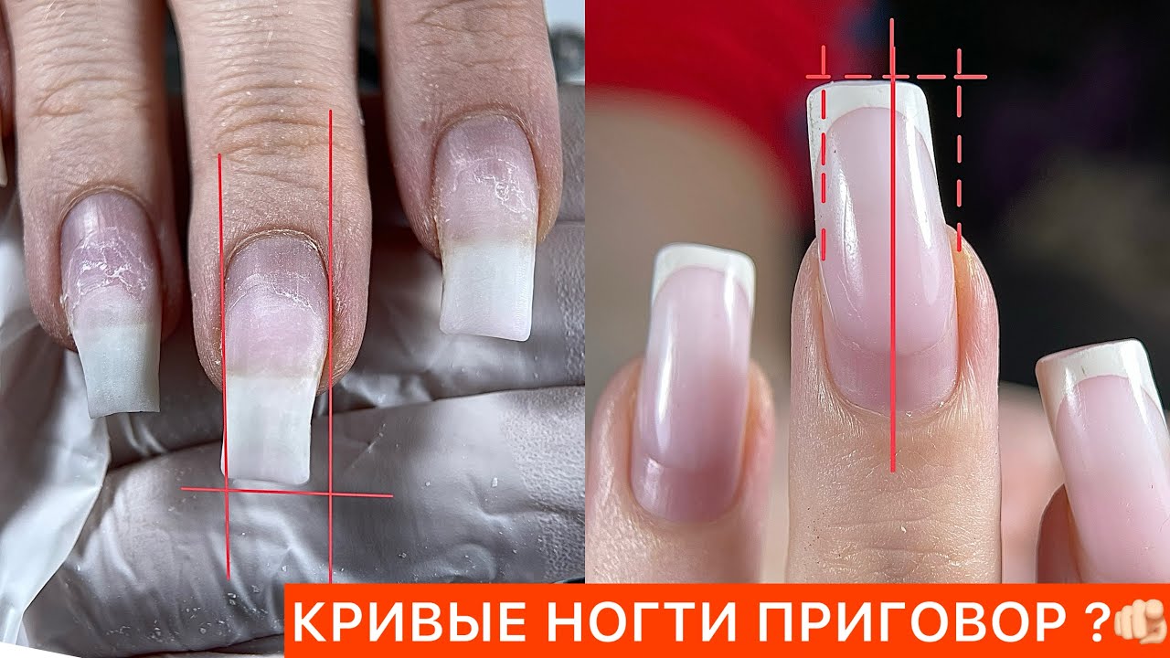 РЕСТАВРАЦИЯ КРИВЫХ НОГТЕЙ И ФРЕНЧ 🙌