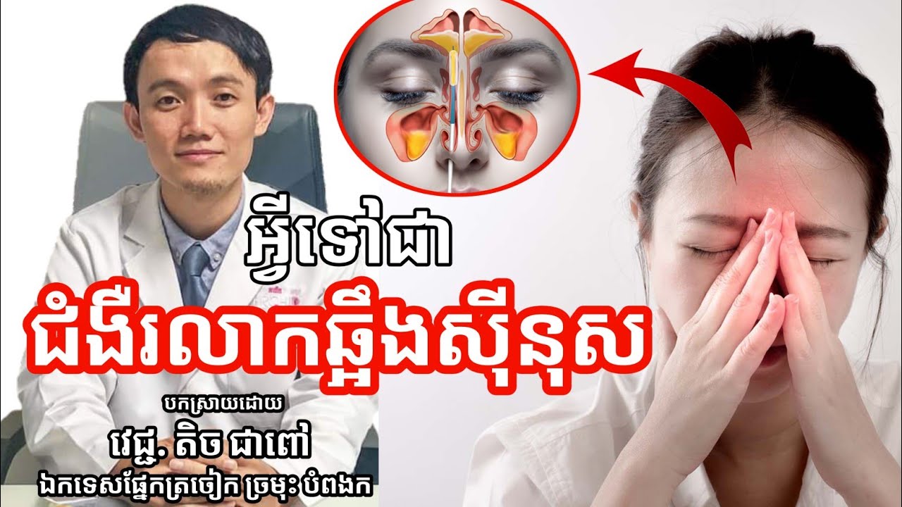 ជំងឺរលាកឆ្អឹងស៊ីនុស Sinusitis | វេជ្ជ. តិច ជាពៅ (ឯកទេសវេជ្ជសាស្រ្តផ្នែកត្រចៀក ច្រមុះ បំពងក)