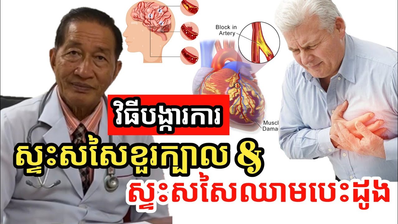 វិធីបង្ការខ្វិនស្ទះសសៃខួរក្បាល និងស្ទះសសៃឈាមបេះដូង | វេជ្ជ. ជ័យ វិទ្យា Chey Vithia
