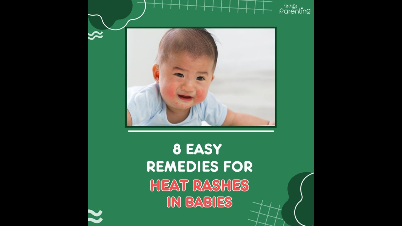 8 Easy Home Remedies for Heat Rash for Children