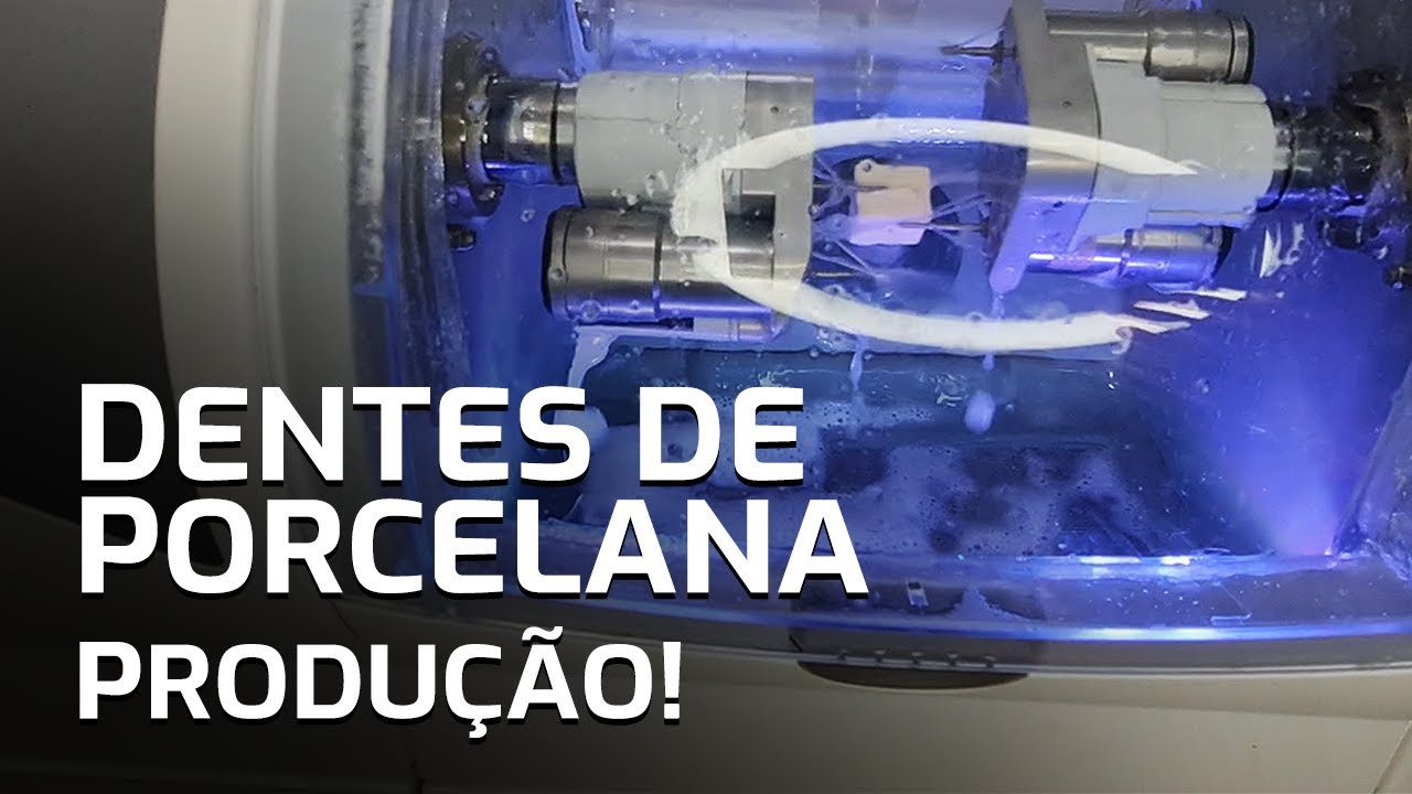 Como s&atilde;o feitos os DENTES DE PORCELANA pela ODONTOLOGIA DIGITAL? CAD/CAM