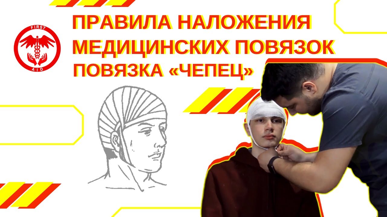 Серия 9. Правила наложения медицинских повязок. Повязка 