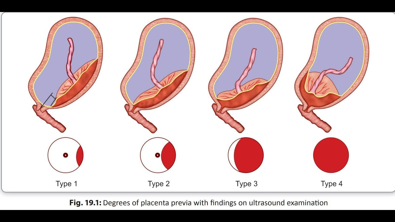 Midwifery (MCH) Class Demo for Loksewa