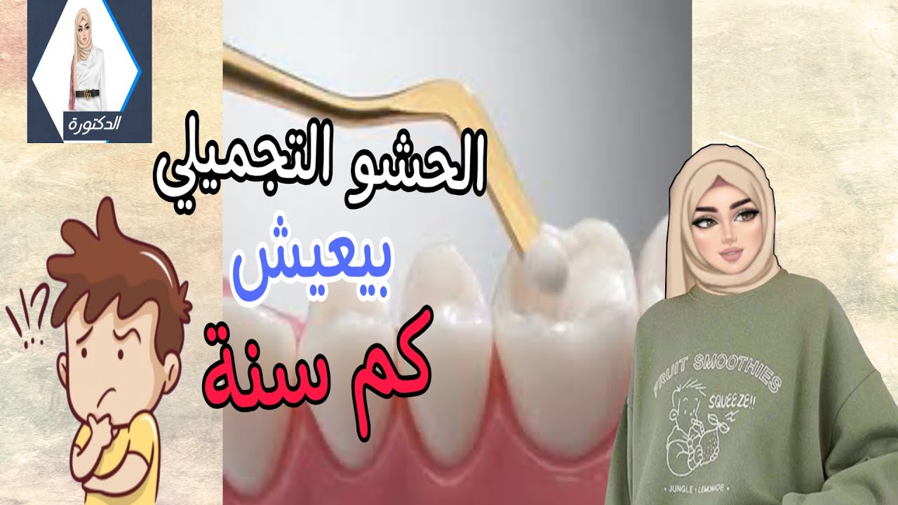 مدة الحشو التجميلي؟وهل الحشوة التجميلية دائمة؟؟